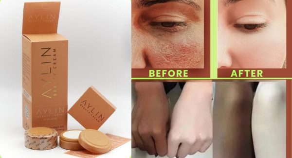Aylin Beauty Cream | Best Whitening Cream for Face | Removes Acne, Pimples & Blackheads | Original Formula